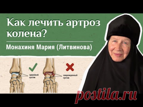 Артроз коленного сустава. «Давайте жить здорово!» Отвечает монахиня Мария (Литвинова)