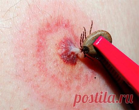 Мифы и правда об укусах клещей Человек не зря боится клещей: укус грозит 60 возможными заболеваниями, в том числе болезнью Лайма (или боррелиозом), вирусными лихорадками, клещевым сыпным тифом или параличом и т.д.