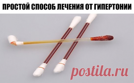 Гипертоники хорошо знают, что ощущения от повышенного давления очень неприятны: сначала - периодические головные боли, сердцебиения, потом — онемение пальцев рук и ног, приливы крови к голове.
Оно производится в два этапа:
Перерыв — десять дней.
Лечение этим способом производится так. Ватку на спичке обмакнуть в йод и довести кольцо:
1-й день — вокруг запястья левой руки;
2-й — вокруг щиколотки правой ноги;
3-й — вокруг запястья правой руки;
4-й — вокруг щиколотки левой ноги;
5-й — вокру
