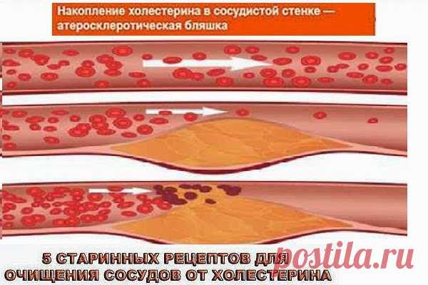 Всё самое интересное!: Хвойный настой с шиповником для очищения сосудов!