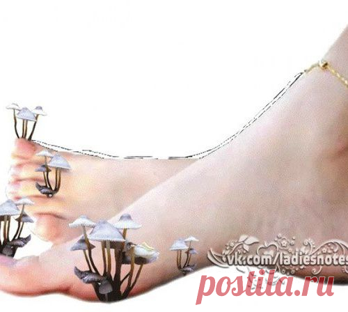 Народные средства лечения грибка,