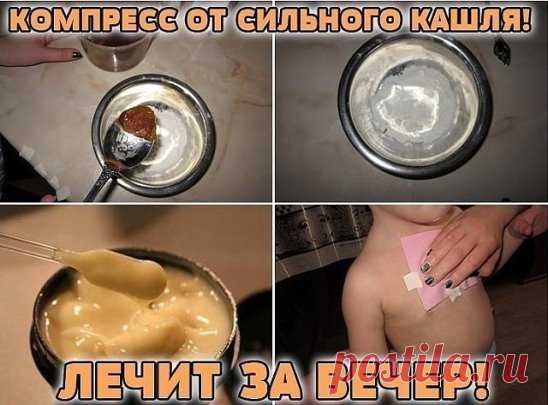 Компресс от сильного кашля! Лечит за вечер