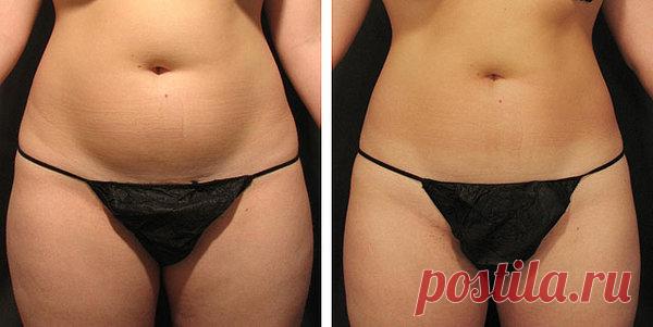 Каждое утро я пила это домашнее средство и за 14 дней избавилась от жира на животе и скинула 5 кг | Худеем вместе | Яндекс Дзен