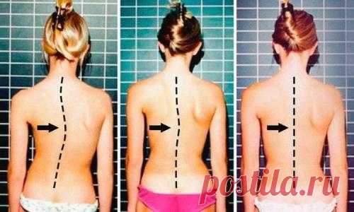 7 упражнений, которые избавят от искривления и болей в спине. Боль в пояснице не шутка. И неважно, какой образ жизни ведет человек - активный или сидячий, - 