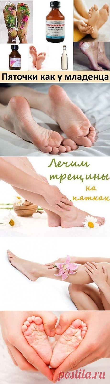 ПЯТОЧКИ-правила и лечение-рабочий вариант