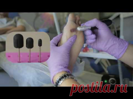 Аппаратный педикюр. Технология выполнения.