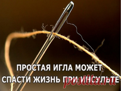 Простая игла может спасти жизнь при инсульте
В чем же заключается простой метод китайской медицины? Когда ударяет инсульт, капилляры в мозгу начинают постепенно разрываться. Сохраняйте спокойствие. Независимо от того, где находится больной, не перемещайте его. Потому что если начать перемещать, капилляры будут лопаться стремительнее! Помогите больному принять устойчивое сидячее положение, чтобы предупредить повторное падение, а затем начинайте кровопускание.
Лучше всего, е...