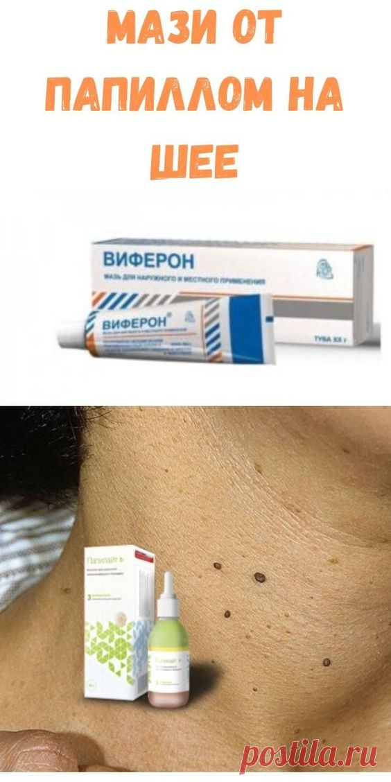 Мази от папиллом на шее
