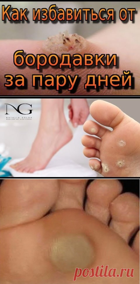 (62) Одноклассники