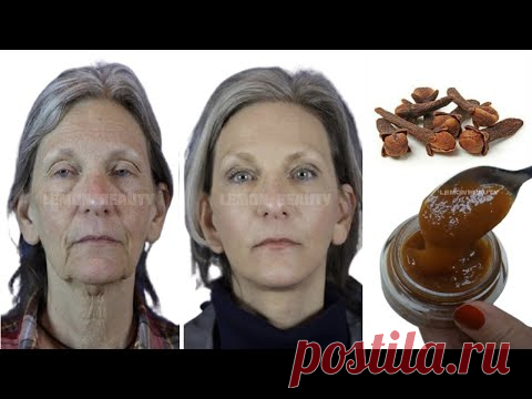 Смешайте гвоздику с водой, чтобы выглядеть на 10 лет моложе своего возраста, натуральный ботокс.