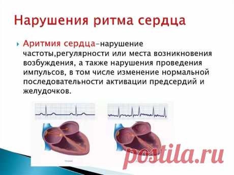 КАК ПОМОЧЬ СЕБЕ ПРИ АРИТМИИ

Экстрасистолия - наиболее часто встречающаяся форма сердечных аритмий. Она может возникать не только в результате сердечных недугов, но и при заболеваниях желудочно-кишечного тракта, мочеполовой системы, остеохондрозе позвоночника, эндокринных нарушениях.

Причиной возникновения экстрасистолии (даже у здорового человека) может быть стресс, переутомление, злоупотребление лекарствами, кофе, курением, алкоголем.

Основными симптомами болезни являю...