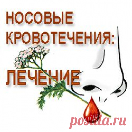 Что делать если идет кровь из носа  |  Рецепт здоровья
