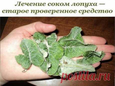 Лечение соком лопуха — старое проверенное средство