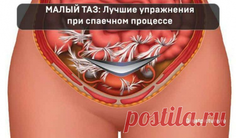 МАЛЫЙ ТАЗ: Лучшие упражнения при спаечном процессе 

Упражнения для улучшение кровообращения в зоне малого таза. Они творят чудеса! 
Показания: спаечный процесс в малом тазу, генитальный инфантилизм, хронический сальпингоофорит в стадии стойкой ремисс…
