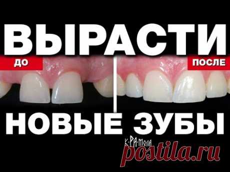 СТОМАТОЛОГАМ ЗАПРЕЩЕНО ОБ ЭТОМ ГОВОРИТЬ. ВЫРАЩИВАНИЕ НОВЫХ ЗУБОВ ВОЗМОЖНО В ЛЮБОМ ВОЗРАСТЕ. ДОКАЗАНО