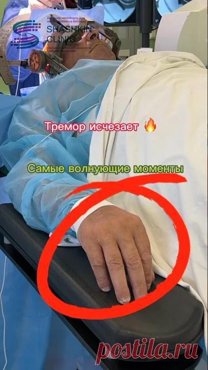 Болезнь Паркинсона, операция на головном мозге, пациент в сознании Parkinson’s disease