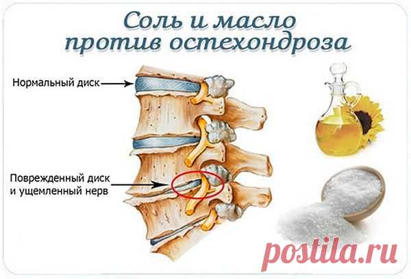 Соль и масло против остеохондроза