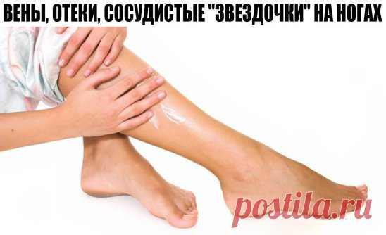 ВЕНЫ, ОТЕКИ, СОСУДИСТЫЕ 