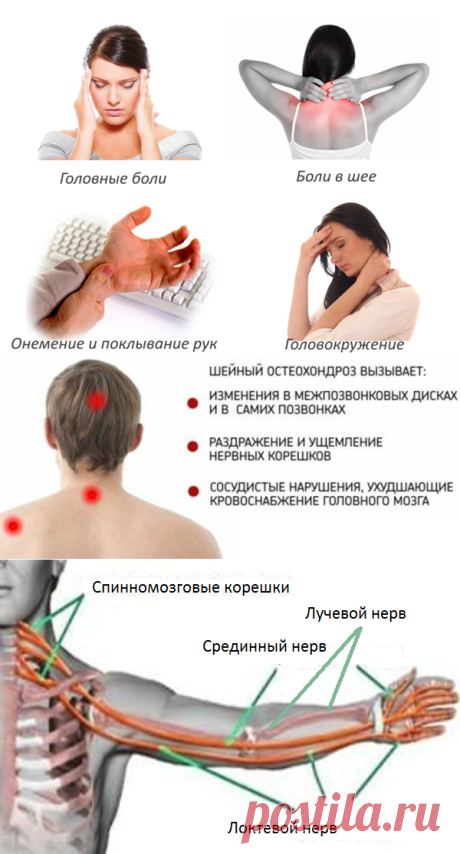 Остеопатия при боли в шее и руке. | Альтернативная медицина | Яндекс Дзен