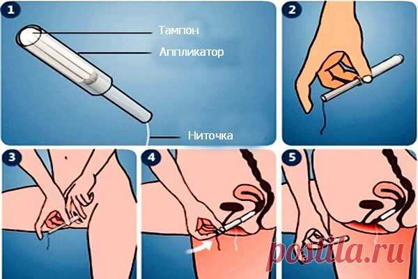 Как пользоваться тампонами в первый раз: как правильно вставлять