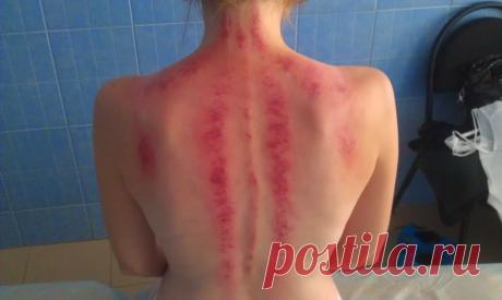 Массаж Гуаша. Показания и противопоказания к массажу гуаша. Его техника и принадлежности