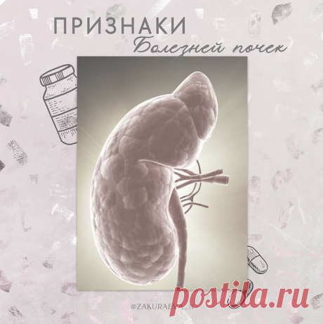 Как понять, что есть болезнь почек | ZdravStudio | Яндекс Дзен