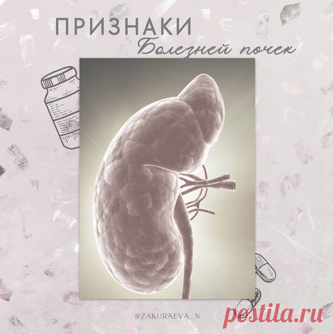 Как понять, что есть болезнь почек | ZdravStudio | Яндекс Дзен