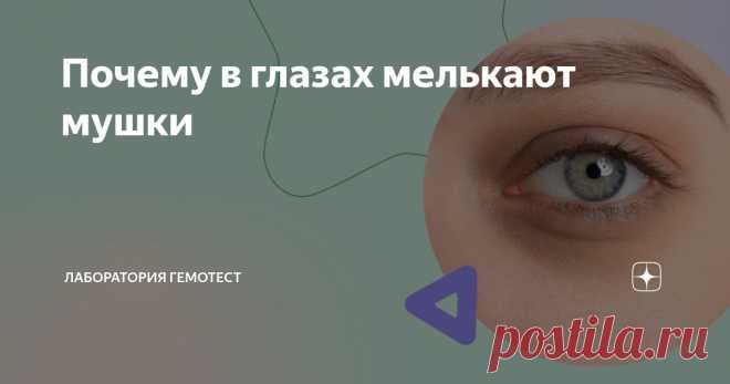 Почему в глазах мелькают мушки Статья автора «Лаборатория Гемотест» в Дзене ✍: Мельтешащие мушки — не галлюцинация и не обман зрения, а особенность, с которой сталкивается каждый четвёртый человек в мире.