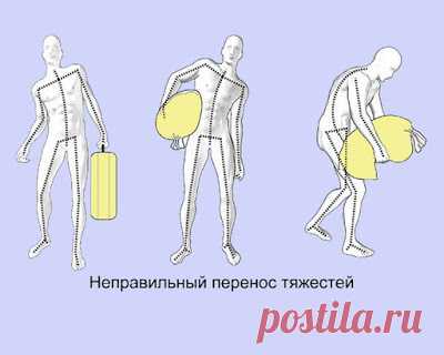 Грыжа поясничного отдела позвоночника: полезные и вредные упражнения - Я ЗДОРОВ! - медиаплатформа МирТесен