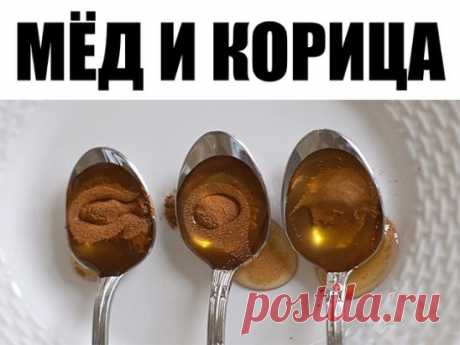 Даже врачи поражаются эффекту от этого средства:
Оно предотвращает сердечный приступ, снижает уровень холестерина и укрепляет вашу иммунную систему!
Эти 2 ингредиента есть на любой кухне! Возможно, вы слышали о многих домашних средствах, которые полезны и помогают оставаться здоровым. Так вот мы сегодня поделимся рецептом удивительного средства, которое рекомендуется диетологами и специалистами.Это сочетание меда и корицы, которое используется в качестве народного средства, на протяжении послед