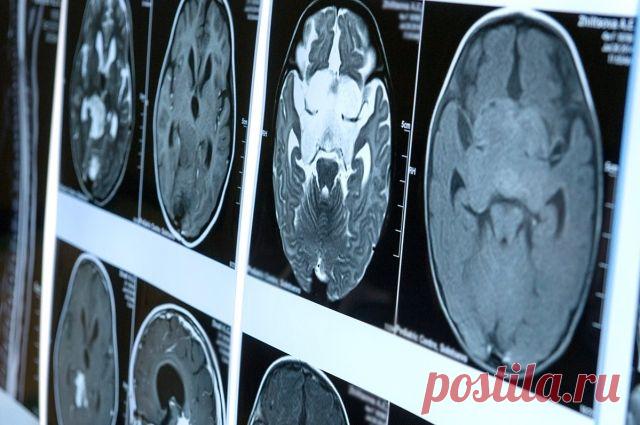 КЛИНИКА ПАМЯТИ. Профилактика деменции у пожилых людей набирает популярность Больше 1,1 тысячи пожилых москвичей за год уже получили помощь и прошли шестинедельный курс реабилитации в «Клиниках памяти», основанных на базе медорганизаций Департамента здравоохранения Москвы.