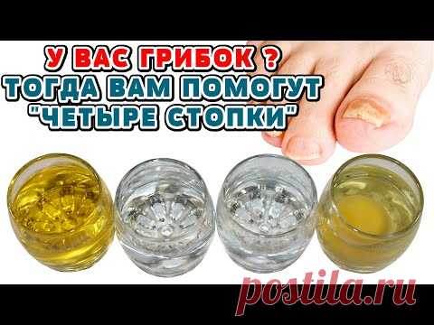 Запущенный ГРИБОК Стоп и Ногтей Легко Вылечить с Помощью 4-х СТОПОК! Не Кормите Аптеки!