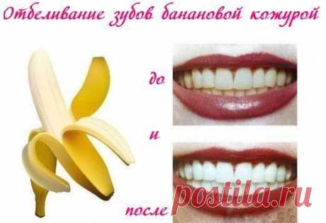 Отбеливание зубов банановой кожурой | Женский журнал