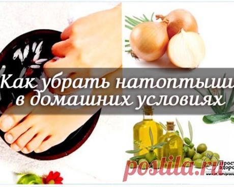 Как убрать натоптыши в домашних условиях