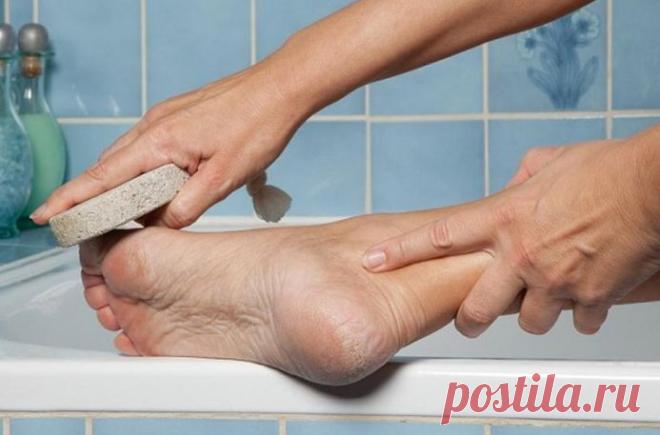 Волшебное средство для ваших пяточек. Моментальный эффект! | Naget.Ru