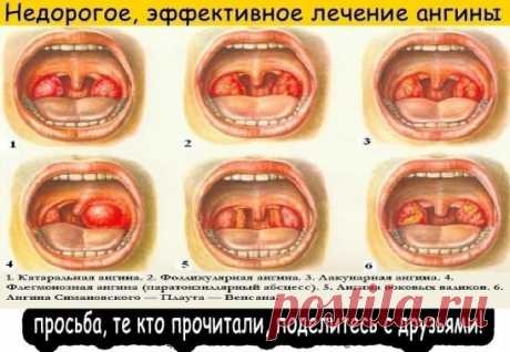 ✔ ПОЛЕЗНЫЕ СОВЕТЫ : 
✪ Сохраните чтобы не потерять.