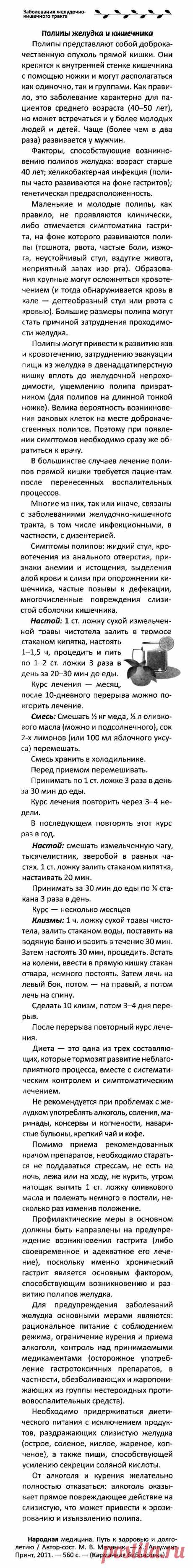 Полипы желудка и кишечника