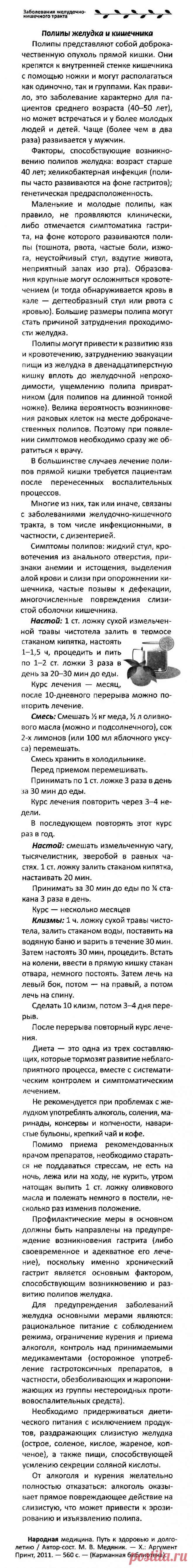 Полипы желудка и кишечника
