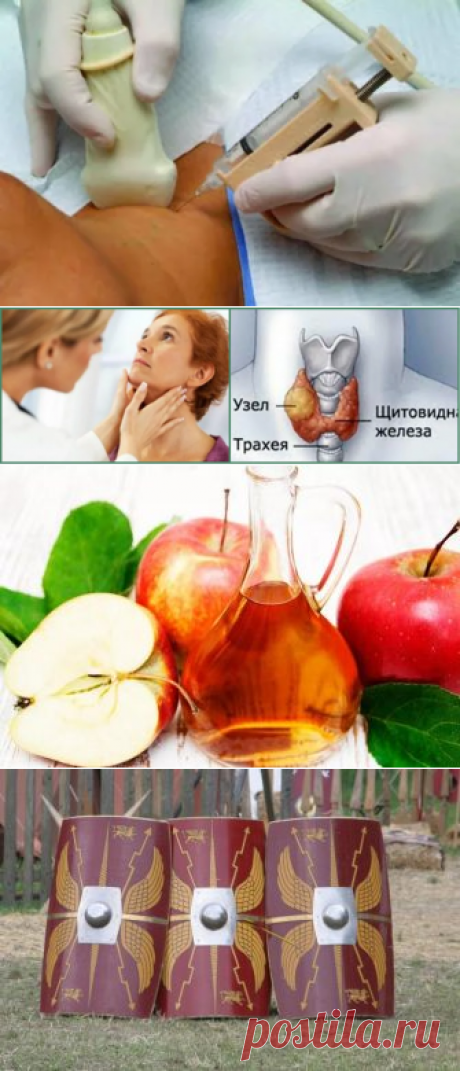 Все тонкости биопсии щитовидной железы
Здравствуйте, дорогие читатели! При наличии узлов щитовидной железы единственный метод определить их характер(злокачественный или доброкачественный)-это тонкоигольная аспирационная биопсия(ТАБ). Процедура эта при грамотном проведении безболезненна и эффективна. Как проводится ТАБ Под контролем УЗИ врач проводит пункцию(укол) в узел щитовидной железы тонкой...
Читай дальше на сайте. Жми подробнее ➡