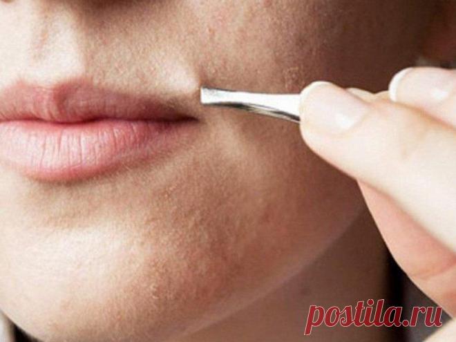 КАК НАВСЕГДА ИЗБАВИТЬСЯ ОТ ЖЕНСКИХ «УСИКОВ» Так просто! И почему я раньше не узналаоб этом способе?!