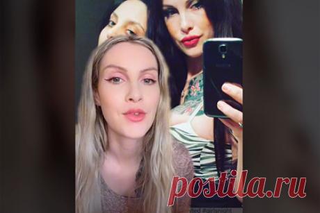 Одержимая филлерами женщина показала искаженное от процедур лицо. Блогерша рассказала о своей одержимости филлерами гиалуроновой кислоты и показала, как в результате исказилась ее внешность. На размещенных в сети кадрах Шелби объяснила, что начала увлекаться косметологическими процедурами с 21 года. Женщина уточнила, что первой ее процедурой было увеличение губ.