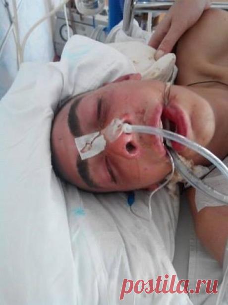 ПРОФСОЮЗА ОДЕССЫ С ОТРАВЛЕНИЕМ УГАРНЫМИ ГАЗАМИ.В СЛУЧАЕ ОПОЗНАНИЯ ПОСТРАДАВШЕГО СООБЩИТЕ ЕГО РОДСТВЕННИКАМ И ПО ТЕЛЕФОНУ ПРИЁМНОГО ОТДЕЛЕНИЯ ВОЕННОГО ГОСПИТАЛЯ - (048) 722-08-55