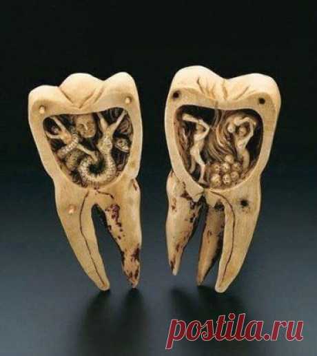 Лечение кариеса народными средствами