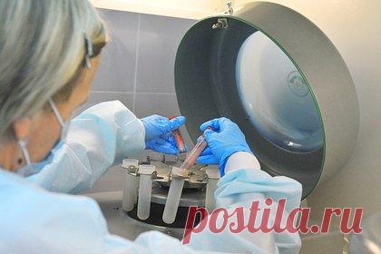 Стало известно о превышении уровня заболеваемости ВИЧ более чем в 30 регионах России