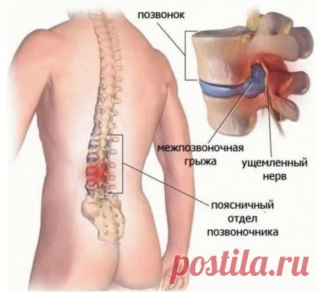Хирург отговорил дядю от операции, посоветовав делать ЭТИ упражнения… Спустя полгода результат!