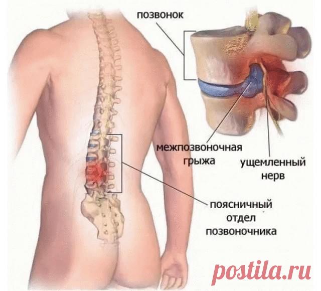 Хирург отговорил дядю от операции, посоветовав делать ЭТИ упражнения… Спустя полгода результат!