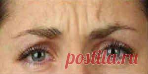 Морщины между бровями - как избавиться, в домашних условиях