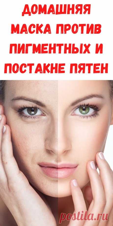 Домашняя маска против пигментных и постакне пятен - Рецепты для женщин Представляем вам удивительное домашнее средство, которое прекрасно удаляет темные пятна на лице, отбеливая кожу, придавая ей ровный, натуральный оттенок.Это почти магический трюк, который помогает сохранять нам нашу кожу без пятен и сделать ее более мягкой и гладкой. Домашняя косметика — это то, что помогает оставаться нам красивыми и при этом экономить кучу денег. Сегодня мы расскажем вам, как […]