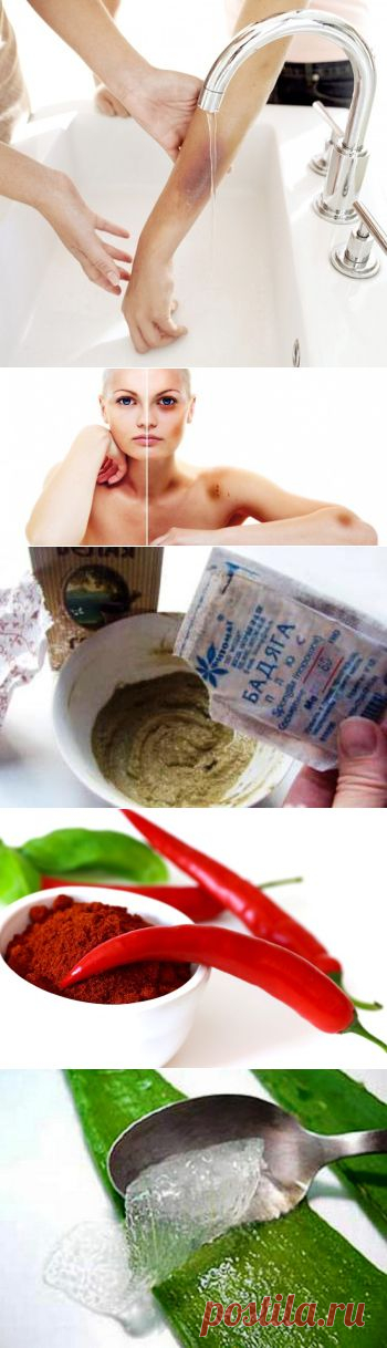 (+1) тема - Как избавиться от синяков | МОЙ ДОМ