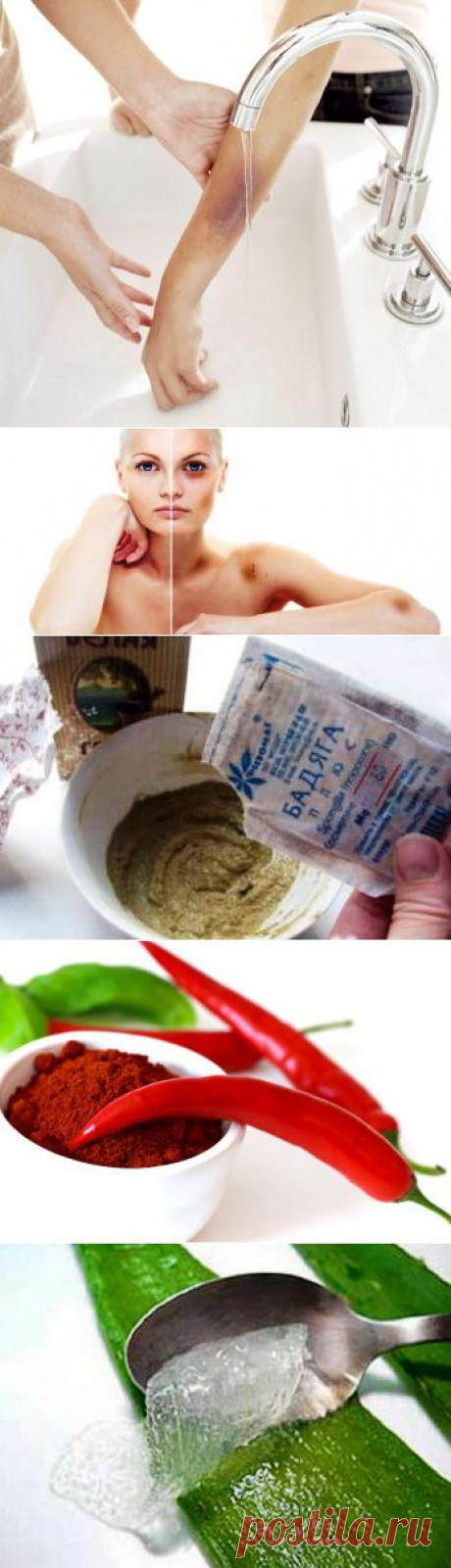 (+1) тема - Как избавиться от синяков | МОЙ ДОМ